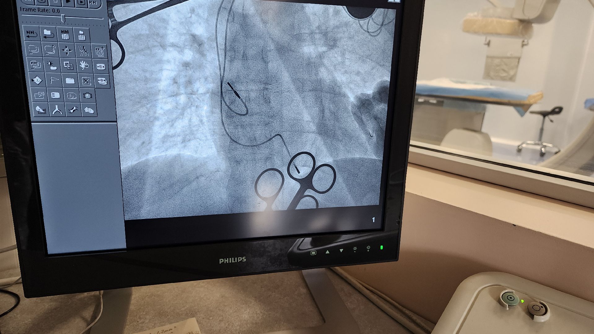 красногорск, медицина, врач, эльбрус,