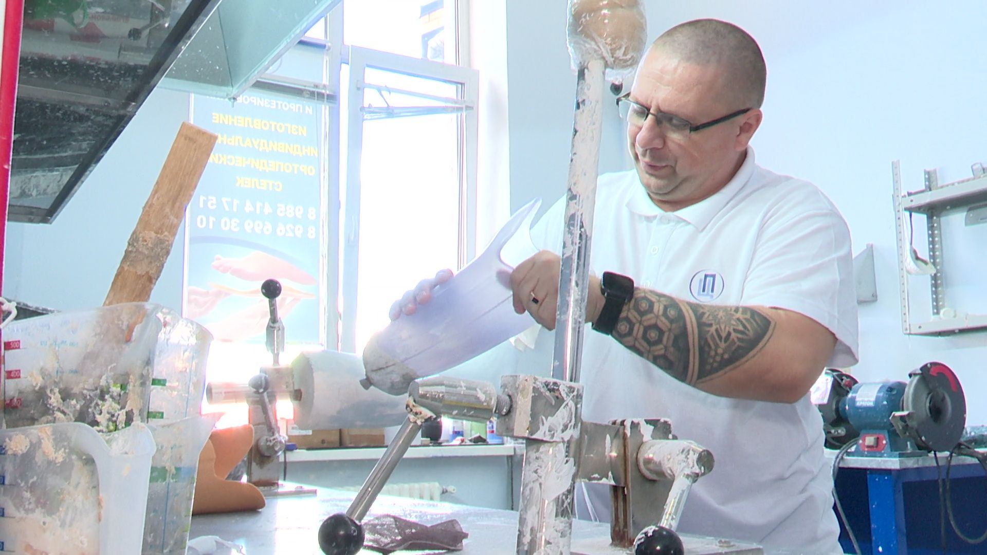 реутов, протез, сво,