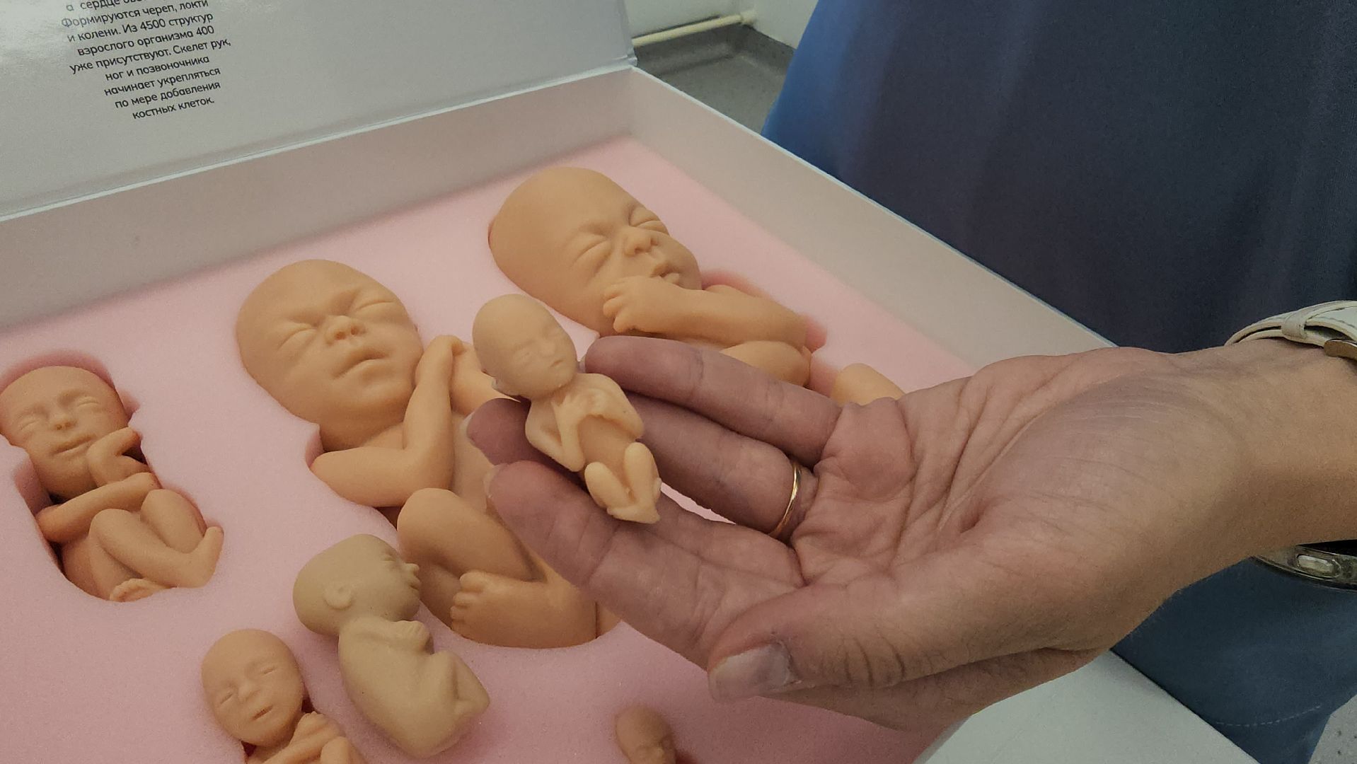 люберецкая областная больница, люберцы, женская консультация, будущие мамы, комплект эмбрионов,