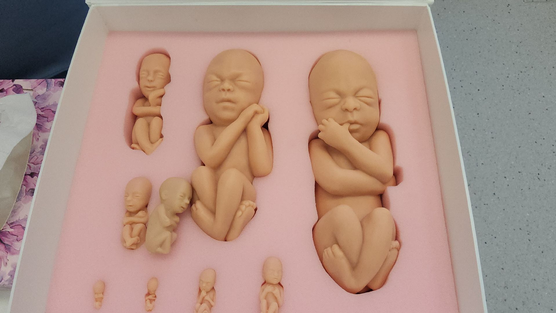 люберецкая областная больница, люберцы, женская консультация, будущие мамы, комплект эмбрионов,