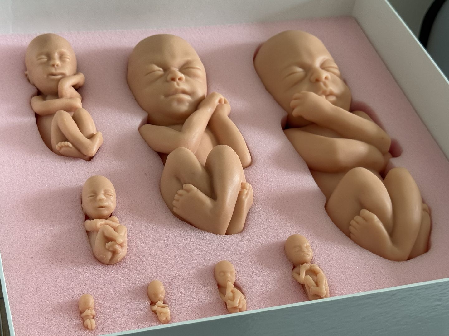 ГП 2 балашиха, поликлиника 2 балашиха, медицина, кабинеты грудного вскармливания,