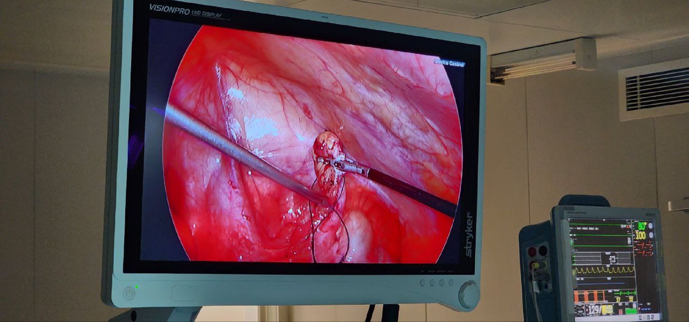 Дмитров, Дмитровская больница, Малоинвазивные операции, Лапароскопическая методика лечения, Минздрав,