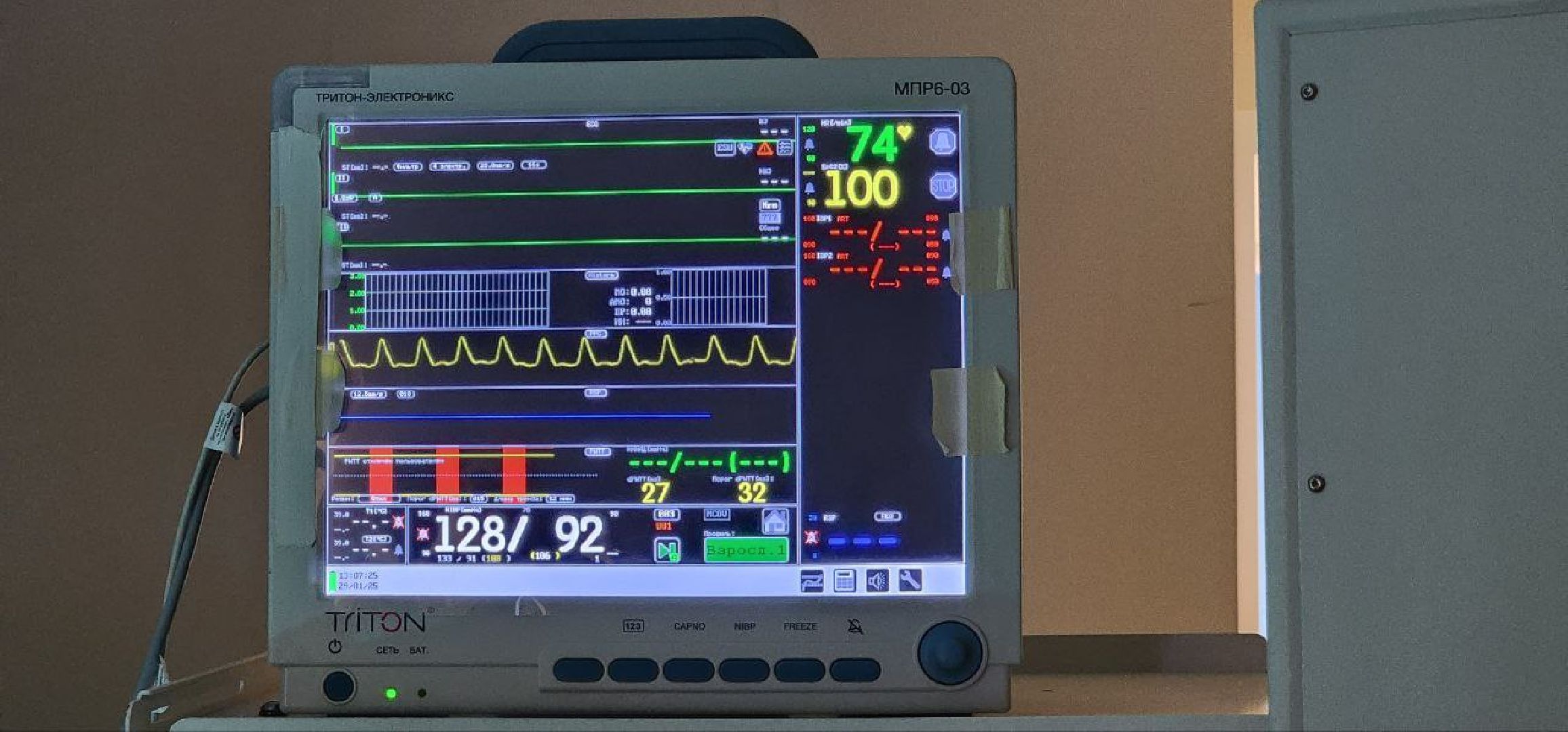 Дмитров, Дмитровская больница, Малоинвазивные операции, Лапароскопическая методика лечения, Минздрав,
