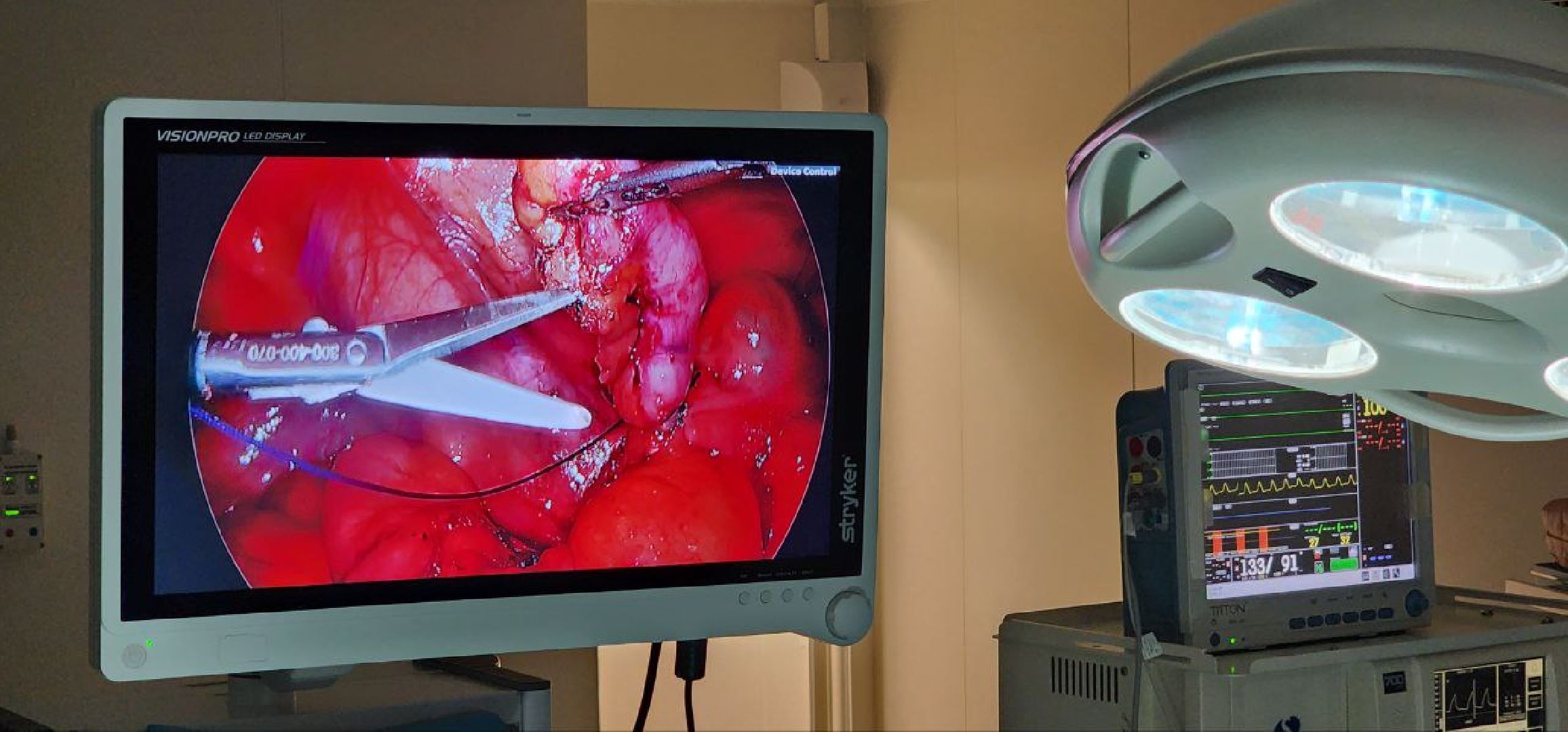 Дмитров, Дмитровская больница, Малоинвазивные операции, Лапароскопическая методика лечения, Минздрав,
