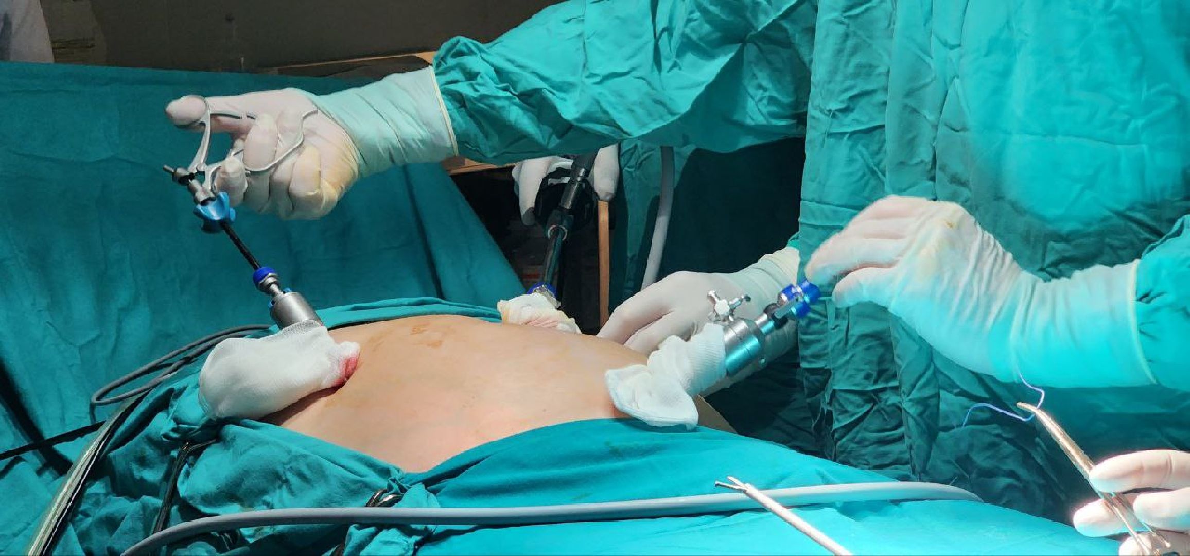 Дмитров, Дмитровская больница, Малоинвазивные операции, Лапароскопическая методика лечения, Минздрав,