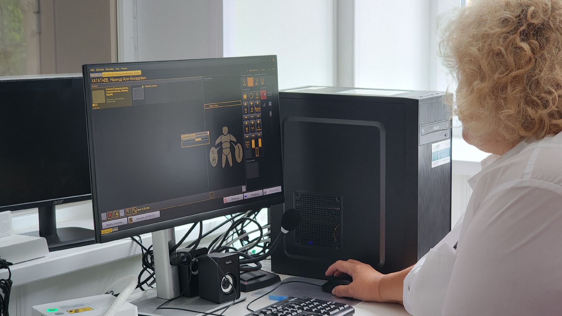 медицина, рентген-аппарат, цифровой рентген-аппарат, лосино-петровский, поликлиника,