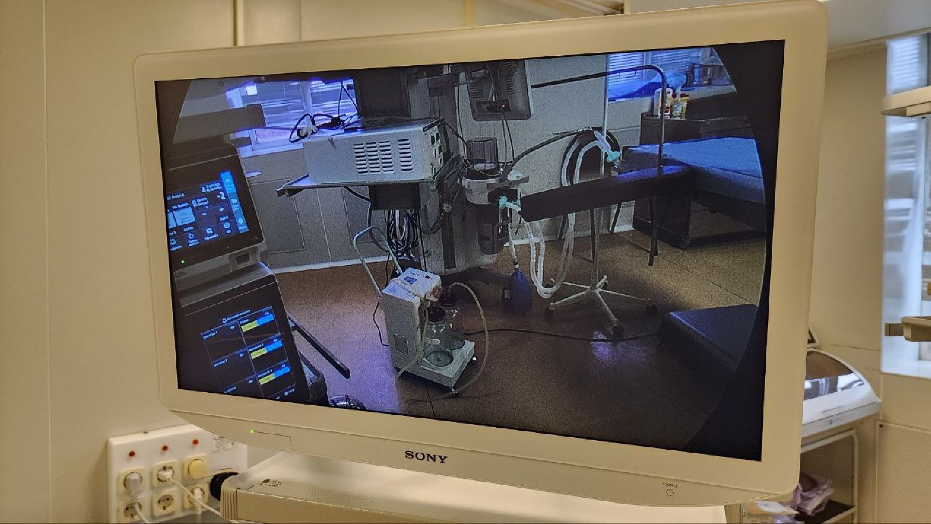 Дмитров, Дмитровская больница, Эндоскопическое оборудование, Малоинвазивные операции, Минздрав,