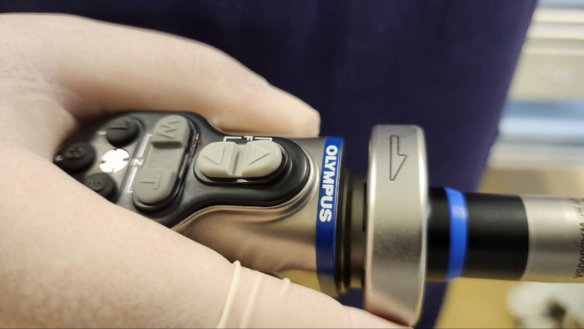 Дмитров, Дмитровская больница, Эндоскопическое оборудование, Малоинвазивные операции, Минздрав,