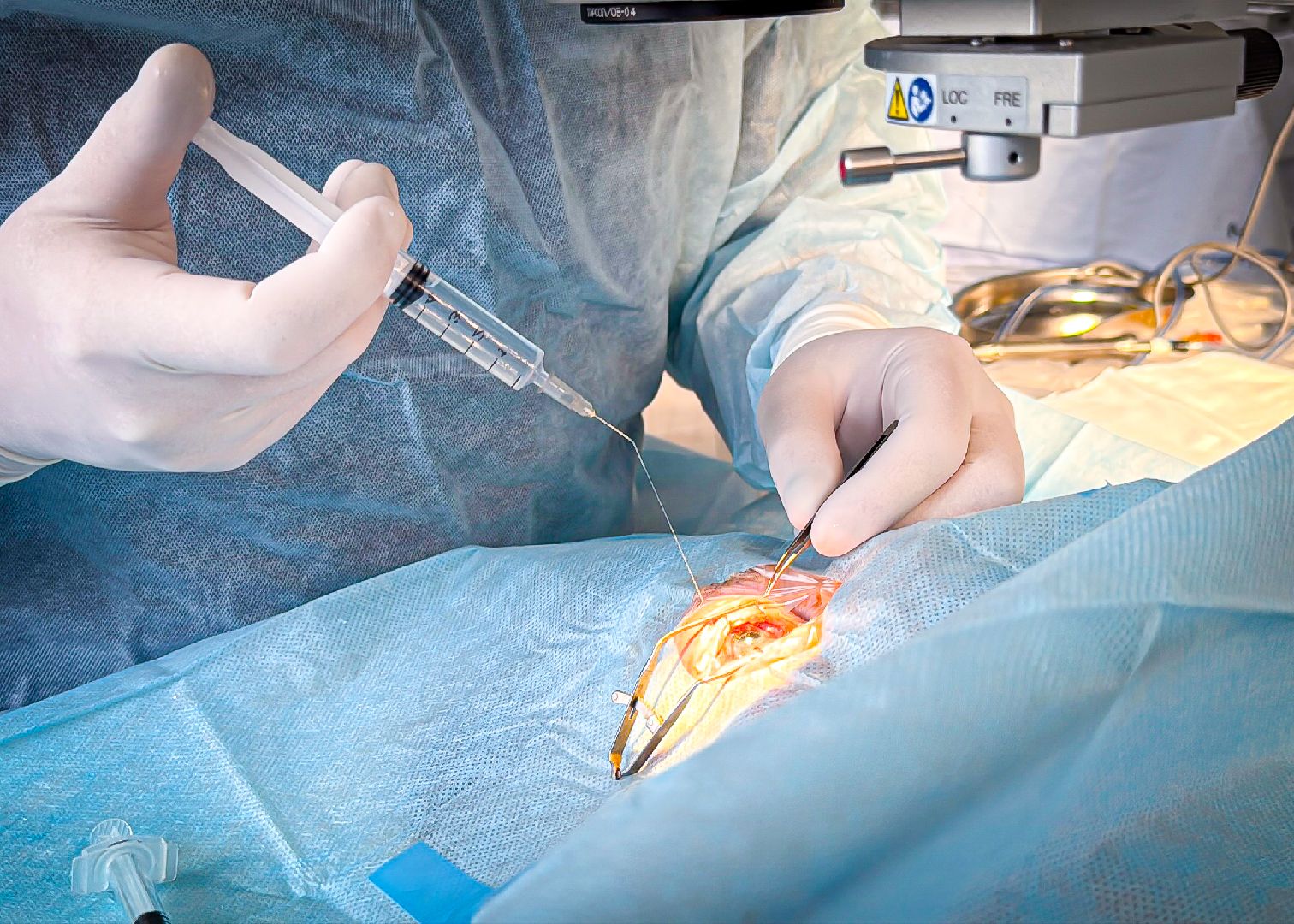 клин, общество, медицина, офтальмология, подмосковье, здоровье, зрение,