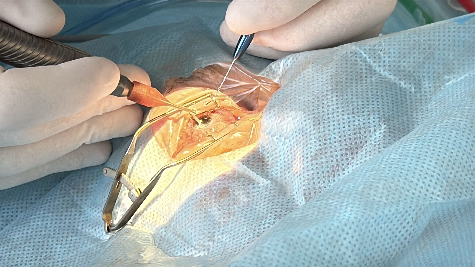 клин, общество, медицина, офтальмология, подмосковье, здоровье, зрение,