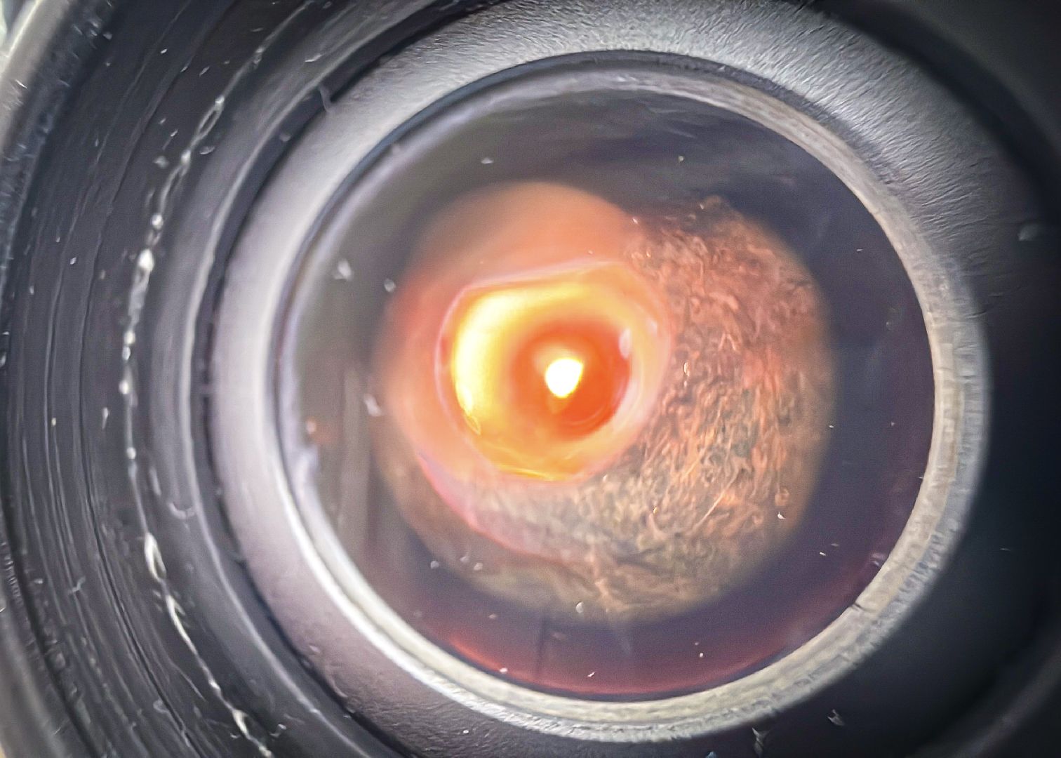 клин, общество, медицина, офтальмология, подмосковье, здоровье, зрение,