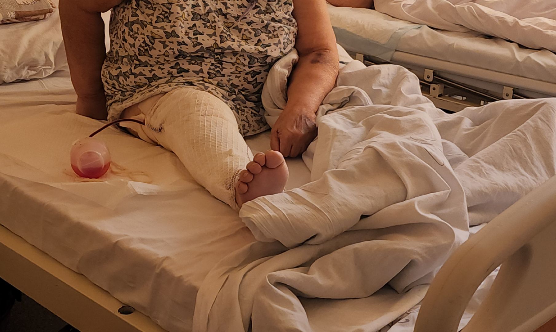 медицина, красногорск, операция,