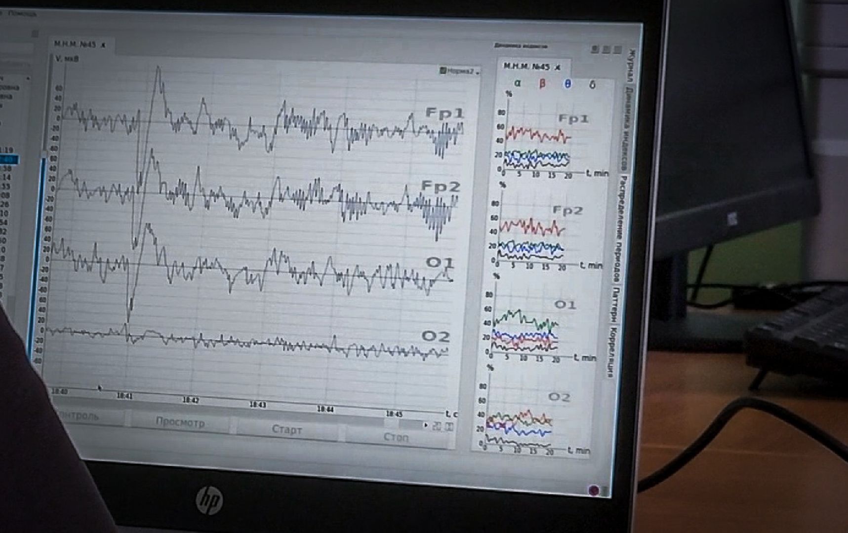 бронницы, дети, метод биоакустической коррекции в бронницах, биоакустическая коррекция в детском саду,