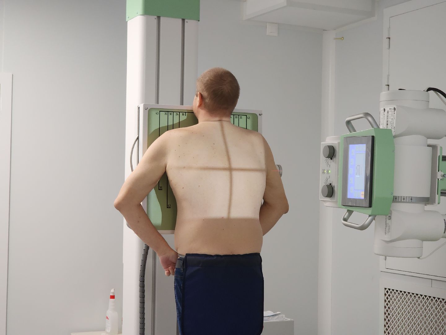 Черноголовка, Медицина, Рентген-аппарат,