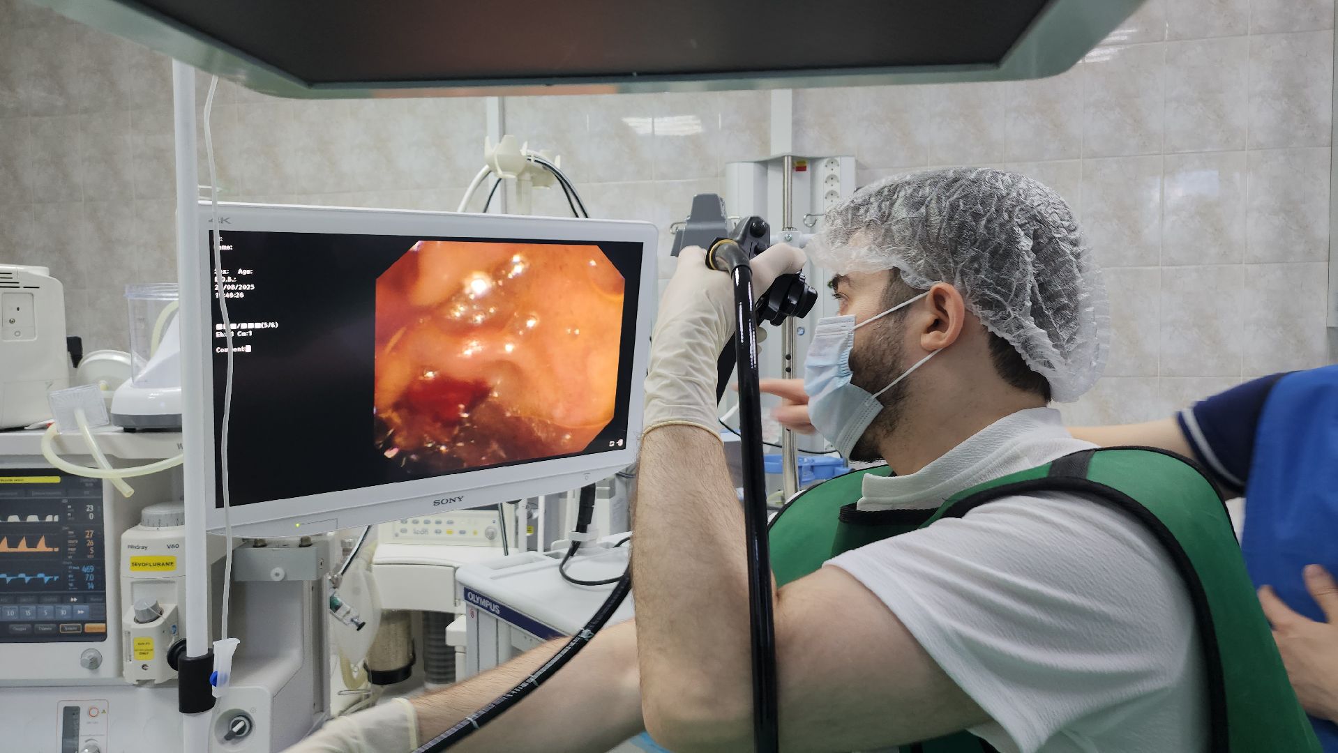 люберцы, люберецкая  областная больница,операция,