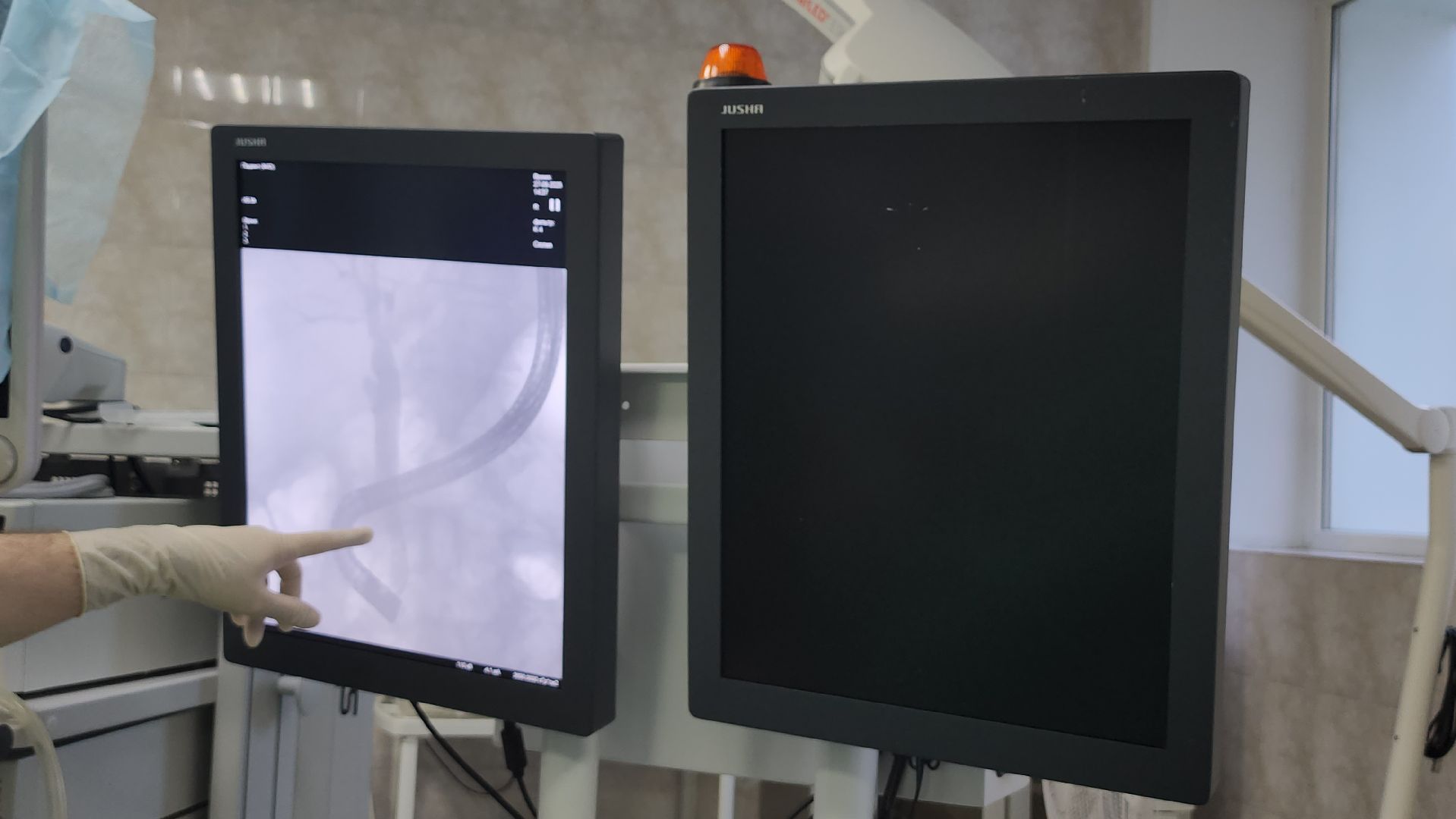 люберцы, люберецкая  областная больница,операция,