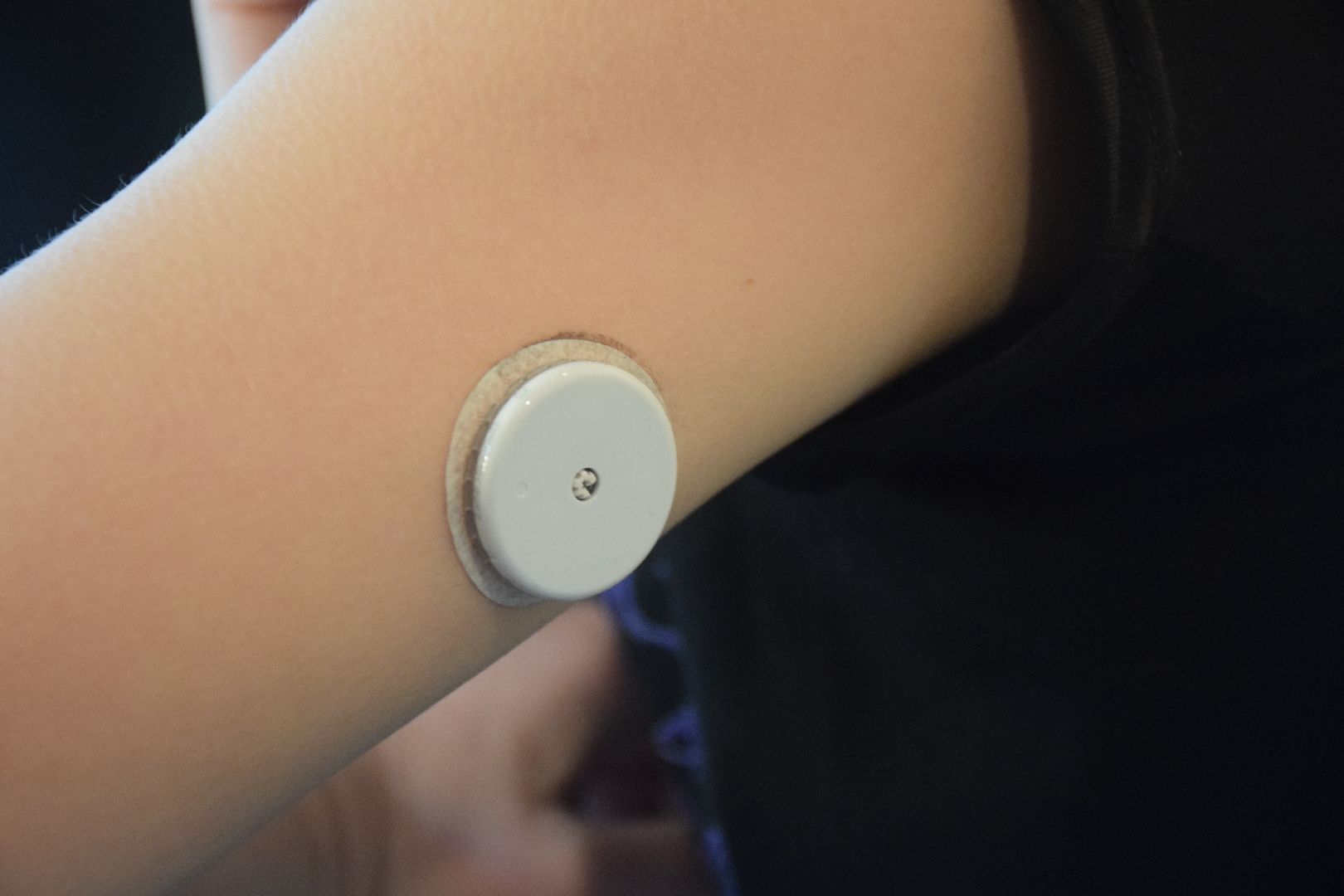 Павловский Посад, городской округ Павловский Посад, медицина, диабет, дети