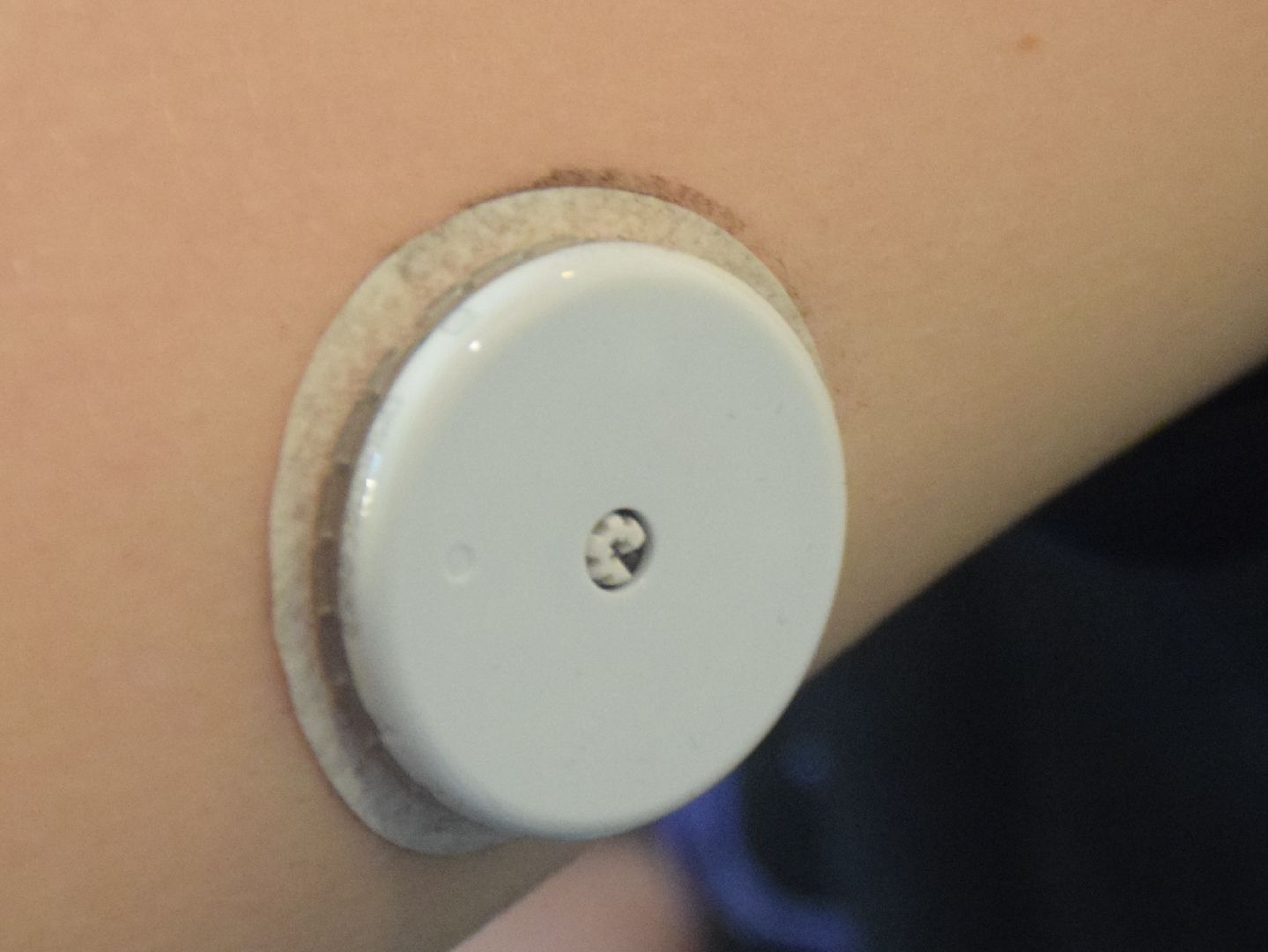 Павловский Посад, городской округ Павловский Посад, медицина, диабет, дети