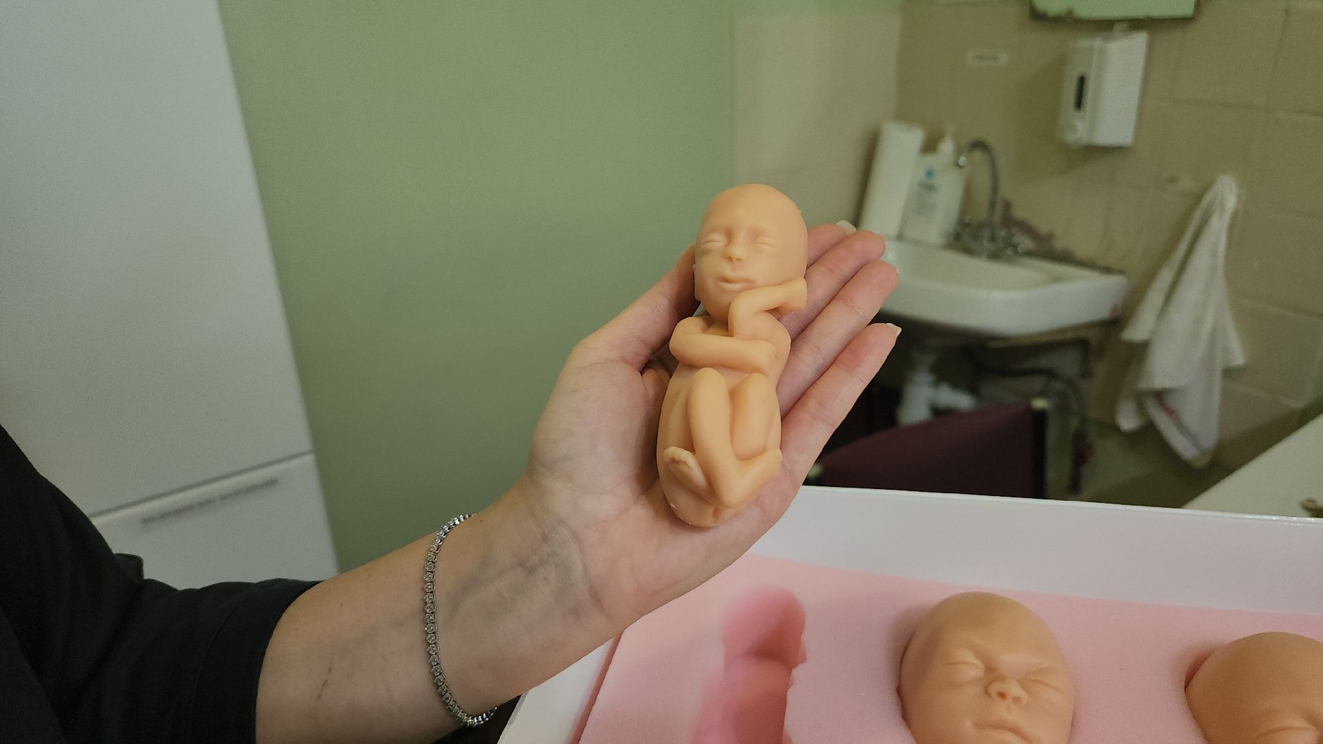 Люберцы, люберецкая больница, комплект эмбрионов, профилактика абортов, женская консультация,