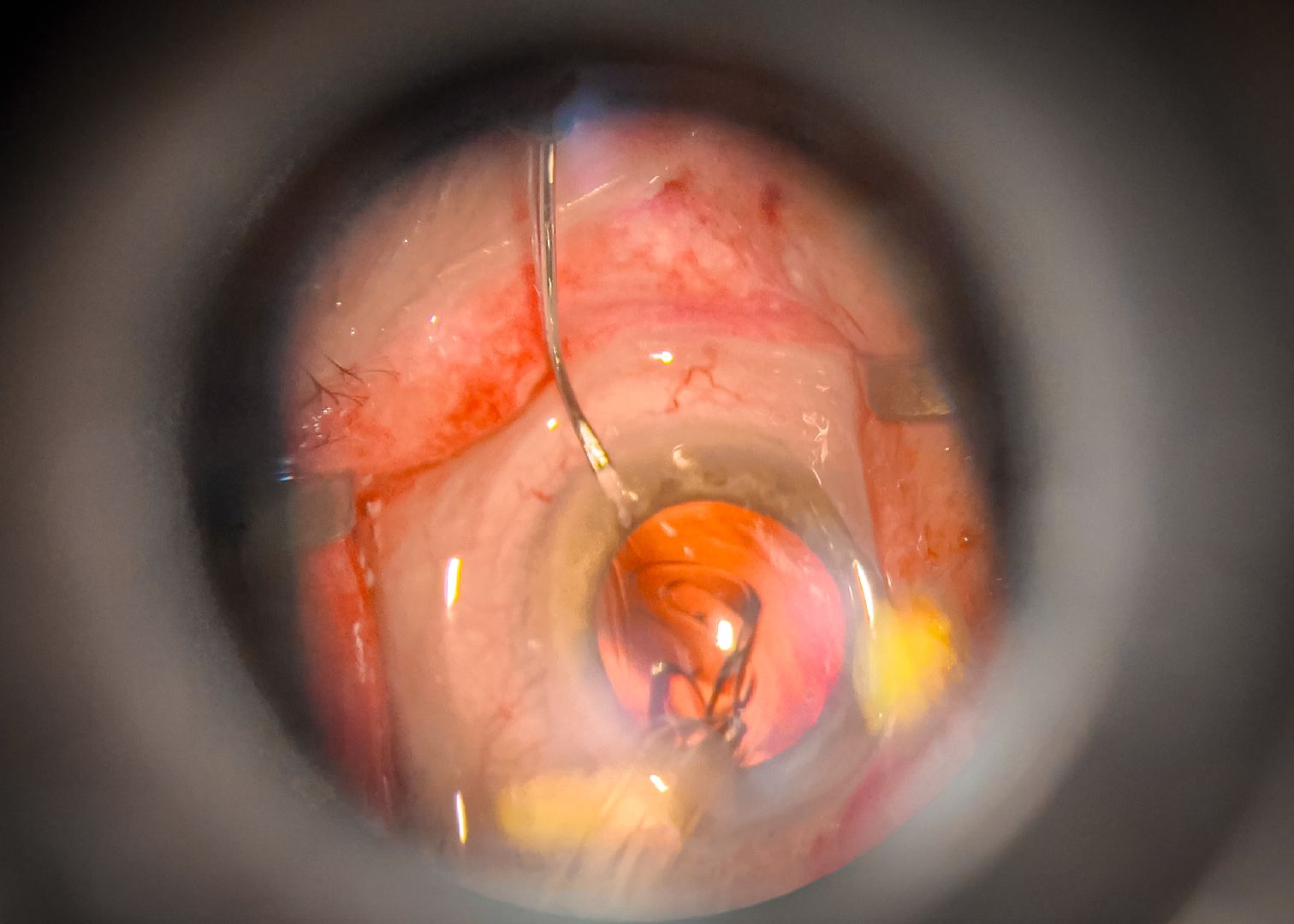 клин, общество, медицина, редкие операции, подмосковье, врачи,