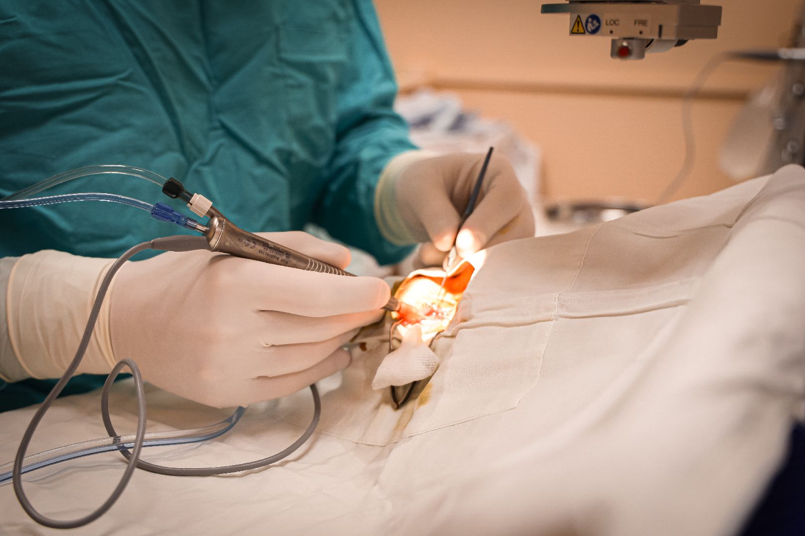 клин, общество, медицина, редкие операции, подмосковье, врачи,