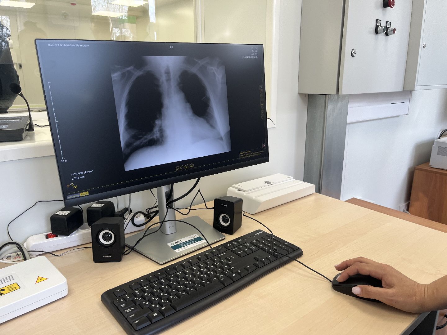 рентген-аппарат, красногорск, медицина,