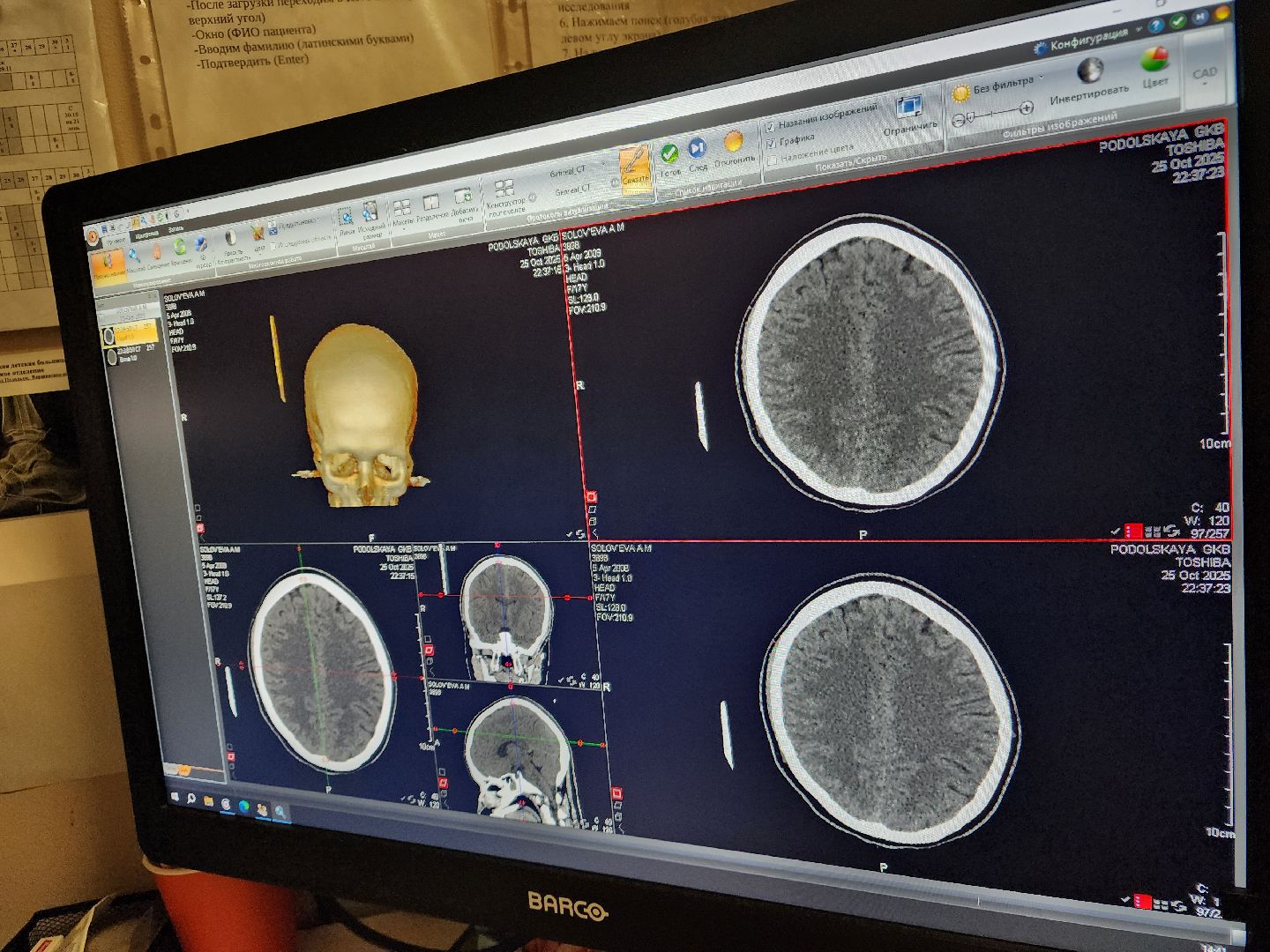 подольск, Происшествие , падение с высоты,Подольская детская больница ,