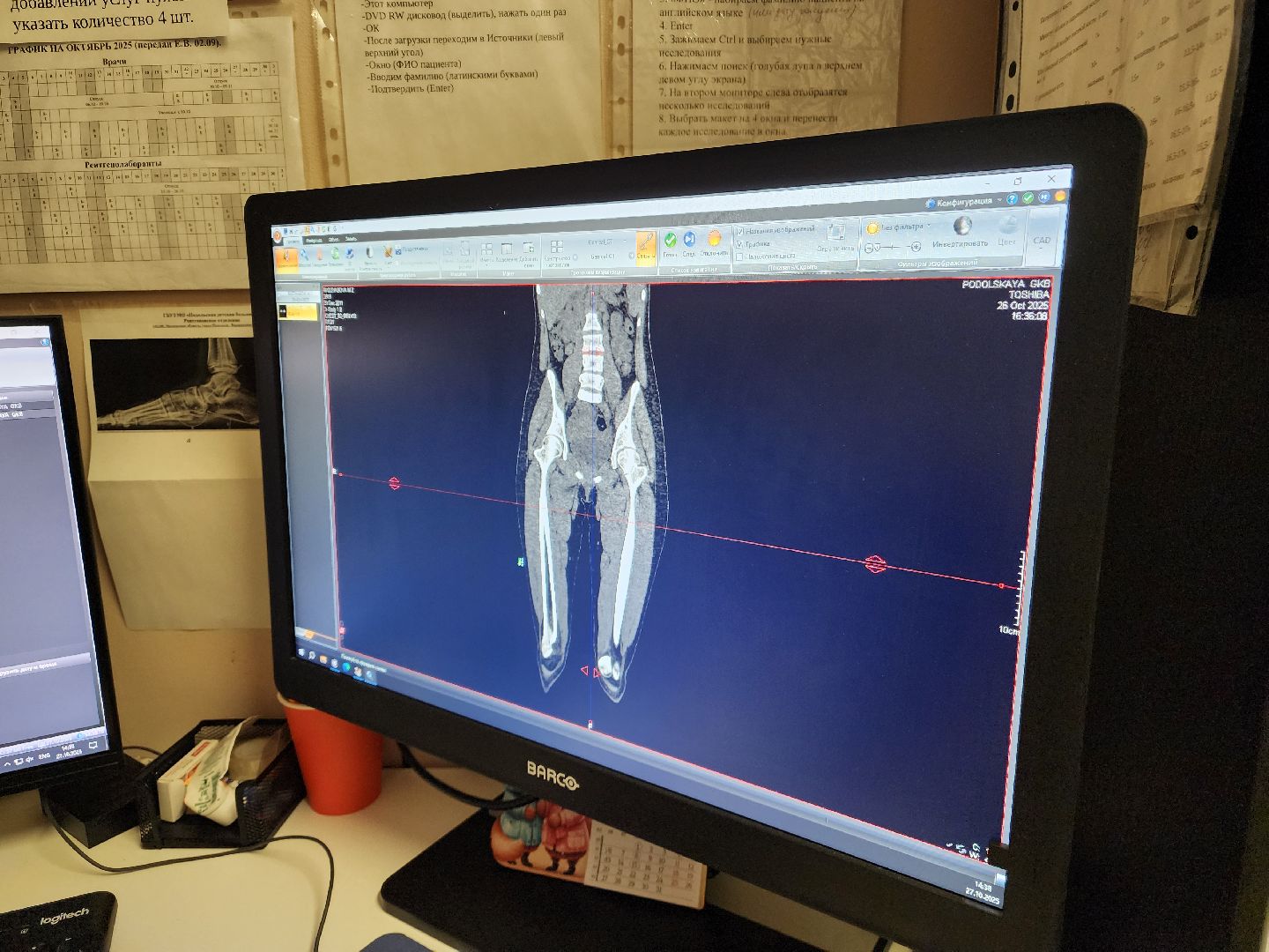 подольск, Происшествие , падение с высоты,Подольская детская больница ,