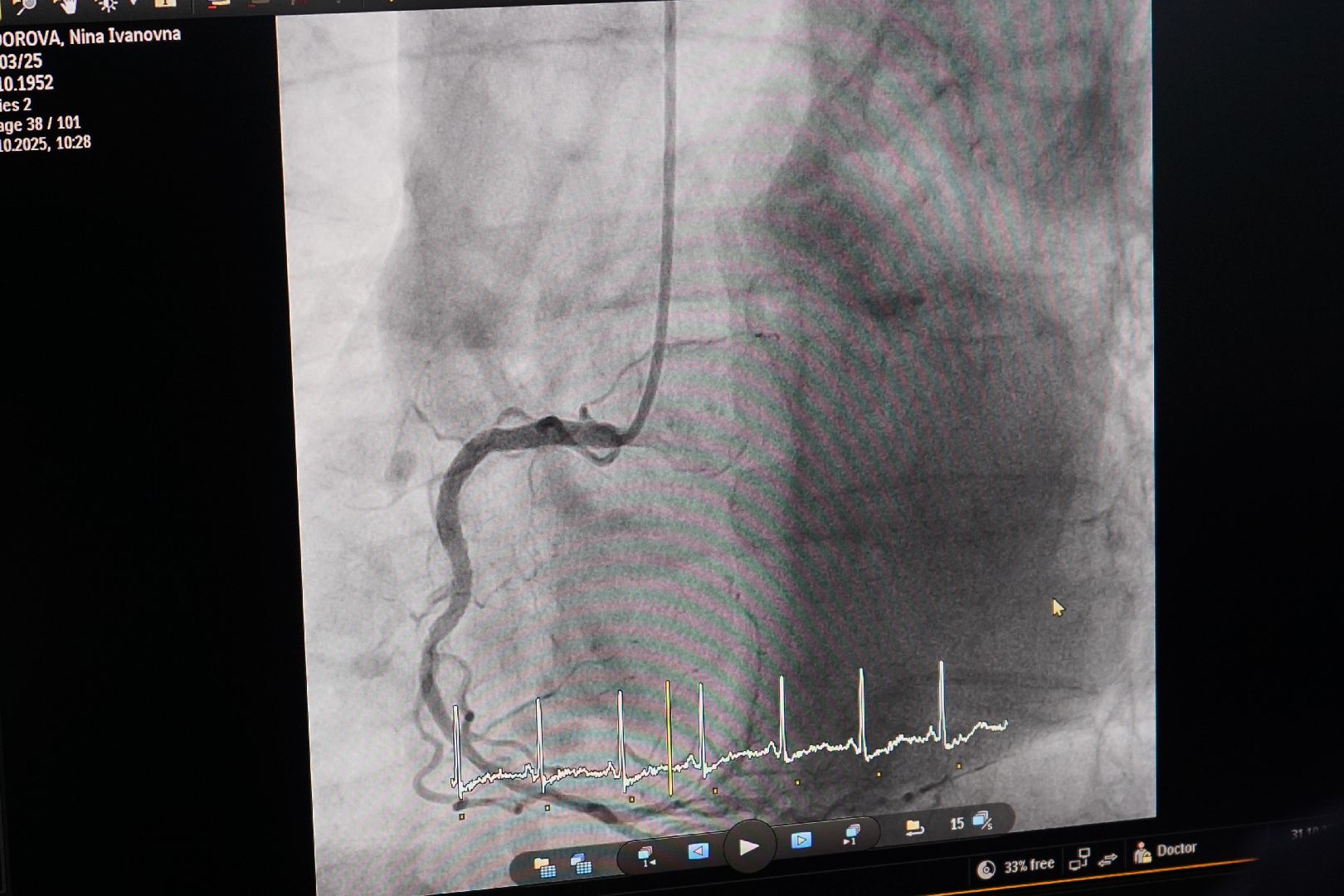 ступино, больница, операция, хирург,