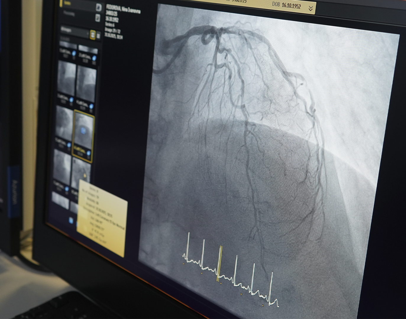 ступино, больница, операция, хирург,