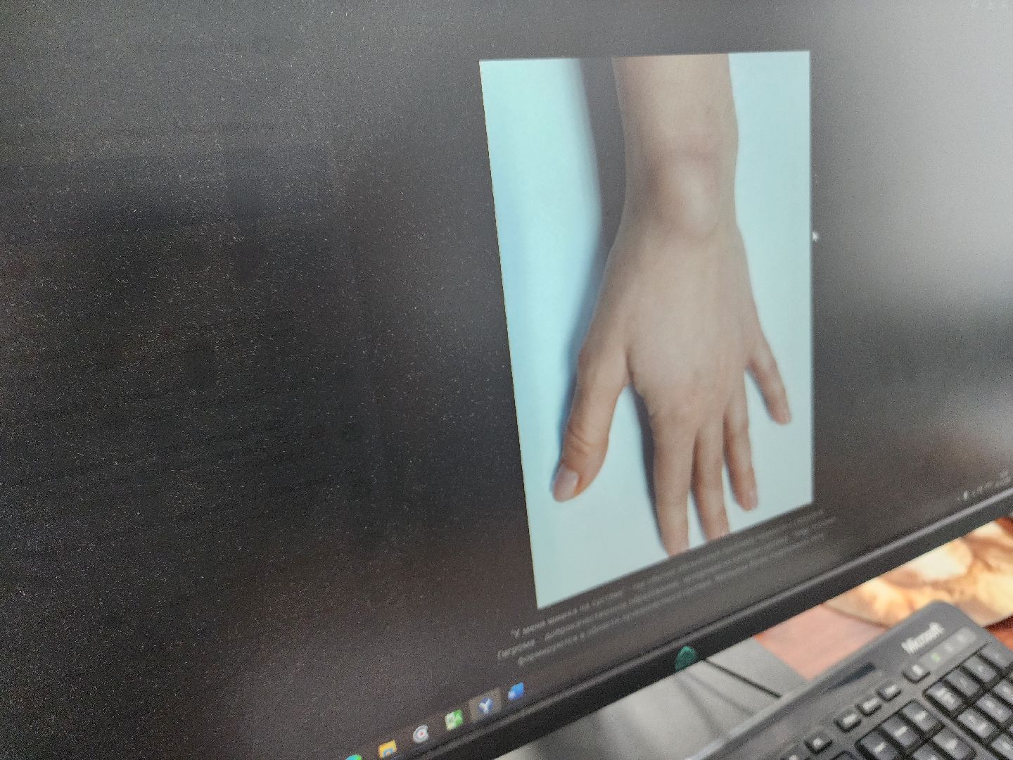 фрязино, суставы, медицина, лечение, профилактика,