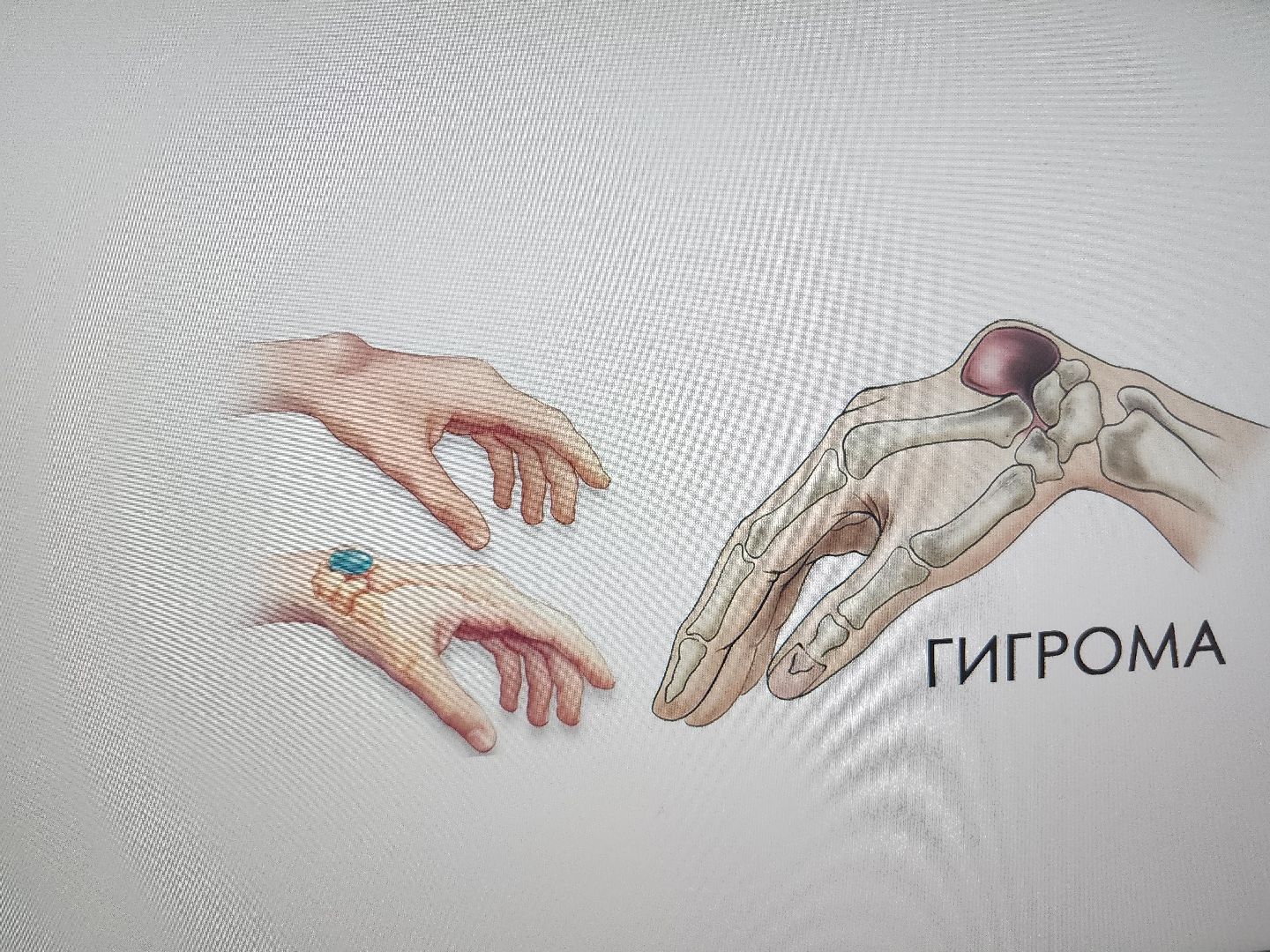 фрязино, суставы, медицина, лечение, профилактика,