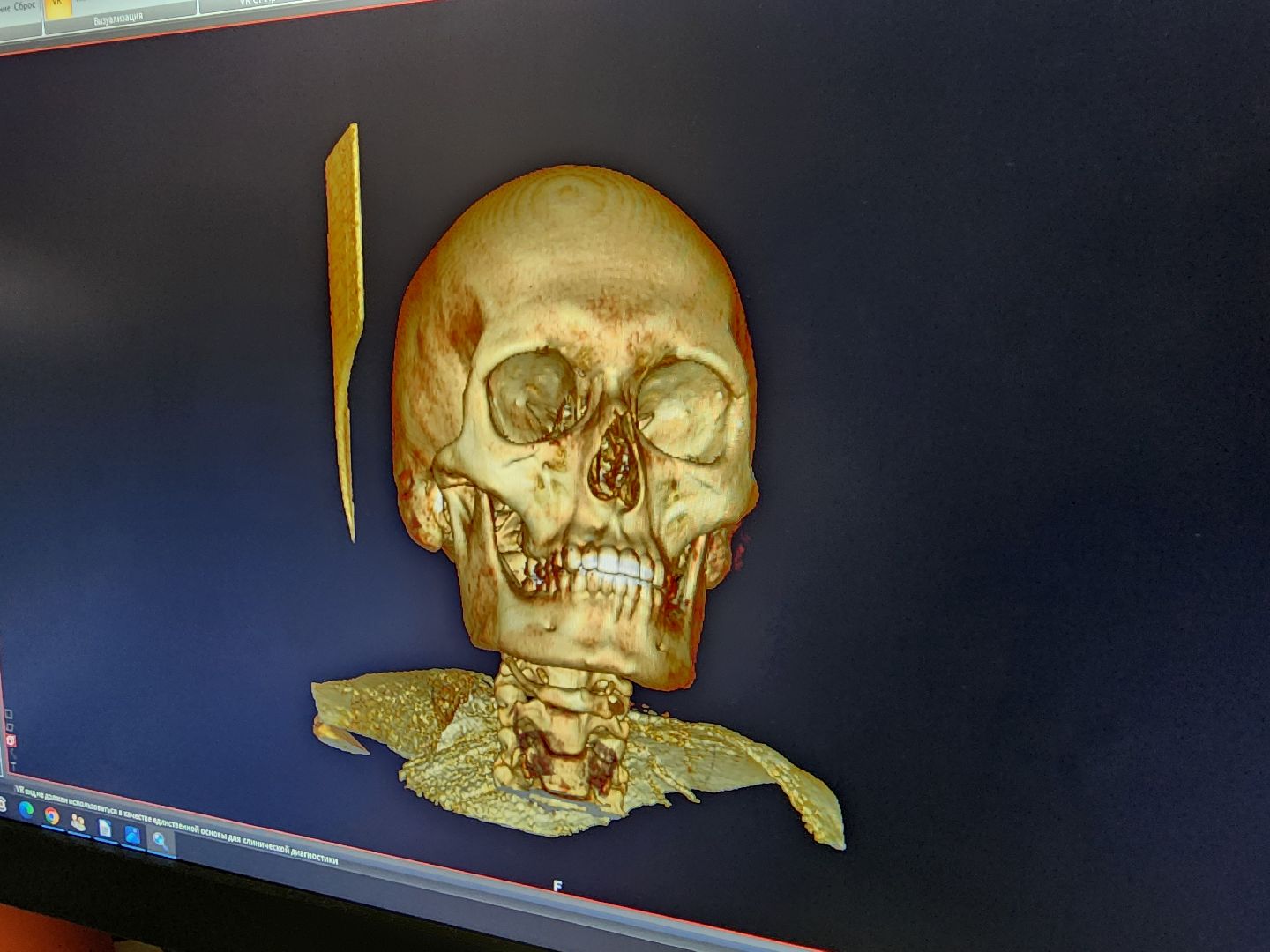 Подольск , подольская детская больница, Бородино,