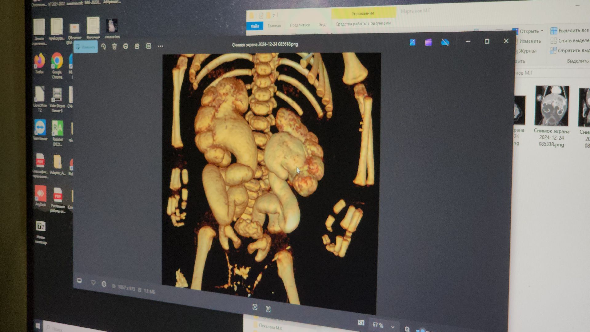 Подольск , Врач-рентгенолог , Праздник, подольская детская больница,