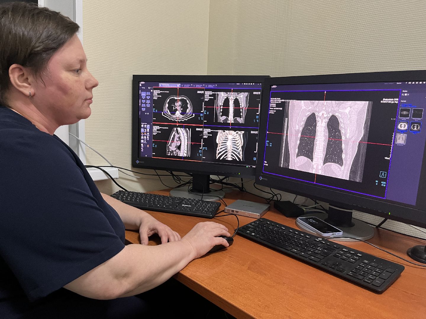 День рентгенолога, шатура медицина, шатура в лицах,