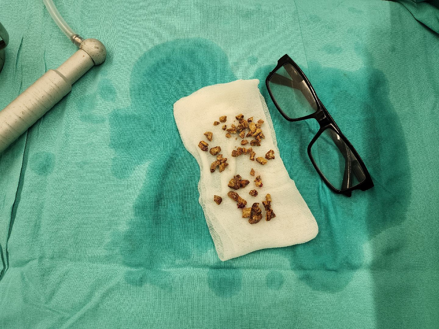 раменское, медицина, раменская больница, кандидат медицинских наук поделился опытом с раменскими урологами ,