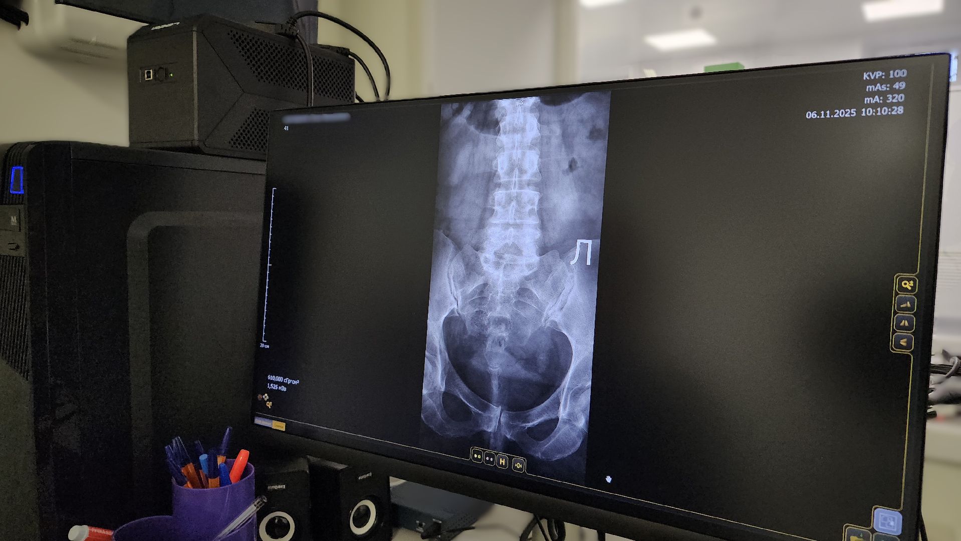 медицина, рентген-аппарат, поликлиника, лосино-петровский,