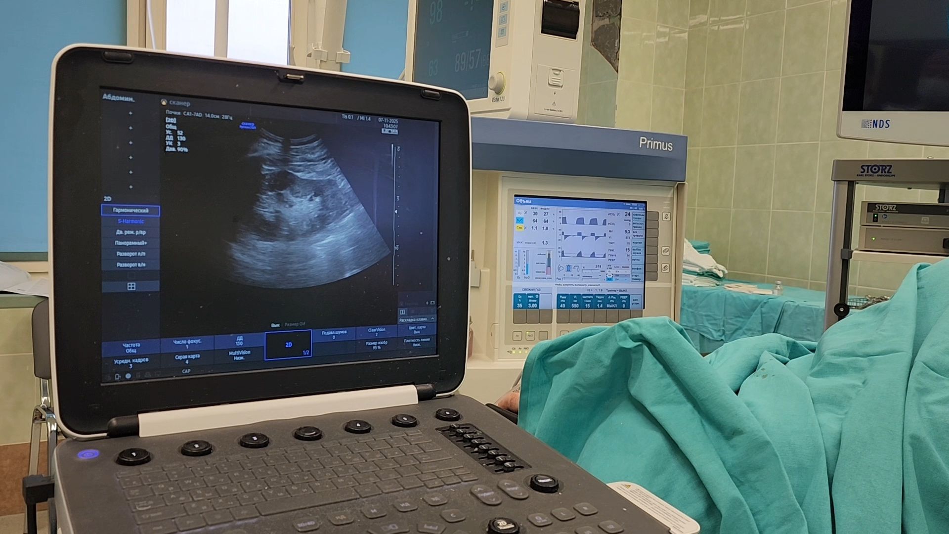 раменское, медицина, раменская больница, малоинвазивные операции в урологии, профилактика и лечение мочекаменной болезни ,