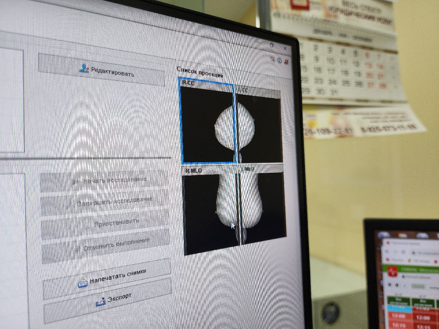 электросталь, медицина, диспансеризация, маммография, врач, общество, жители,