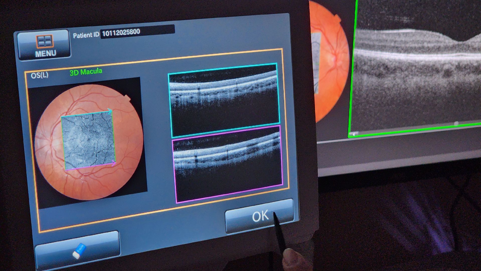 протвино, медицина, день офтальмолога,