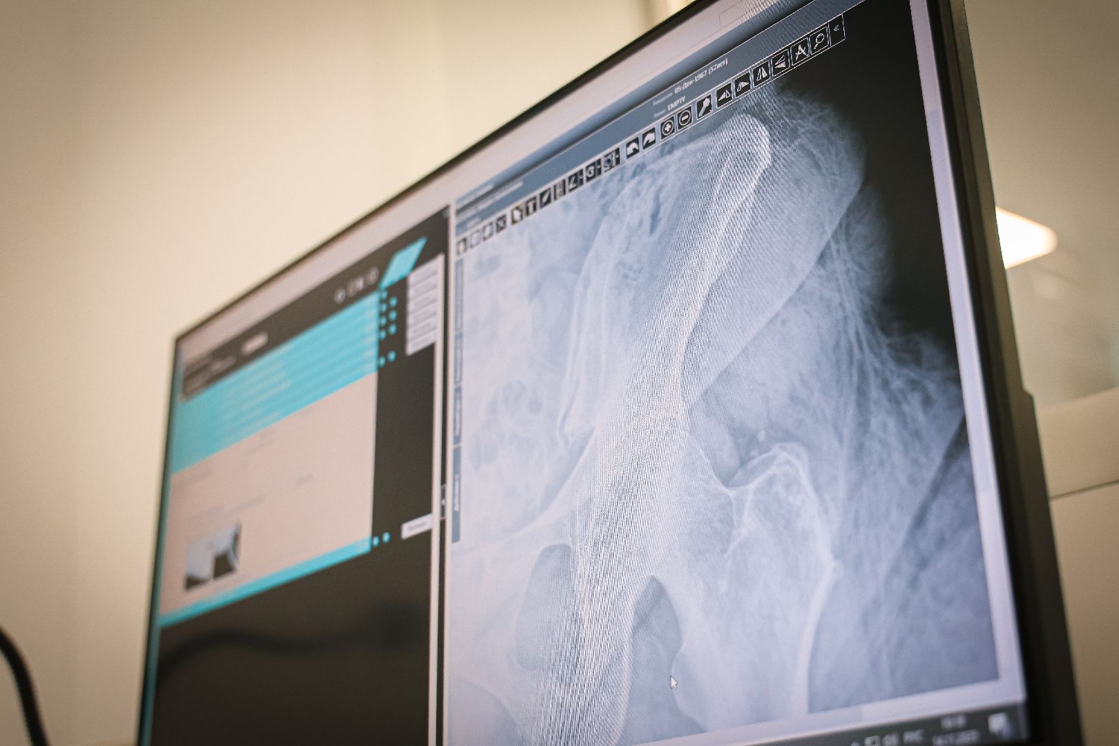 клин, общество, медицина, новое медоборудование, рентген-кабинет, подмосковье,