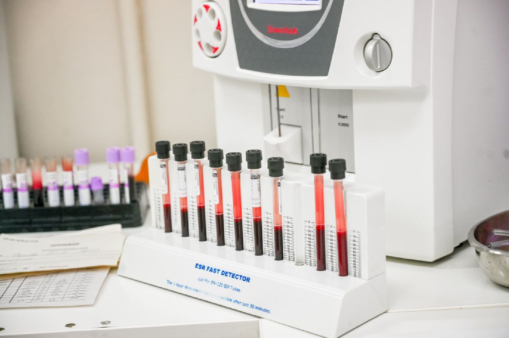 сергиев посад, сергиево-посадский городской округ, пересвет, фмба россии,диспансеризация, диспансеризация населения, выявление болезней на ранних стадиях,ЦМСЧ 94 ФМБА, цмсч 94,