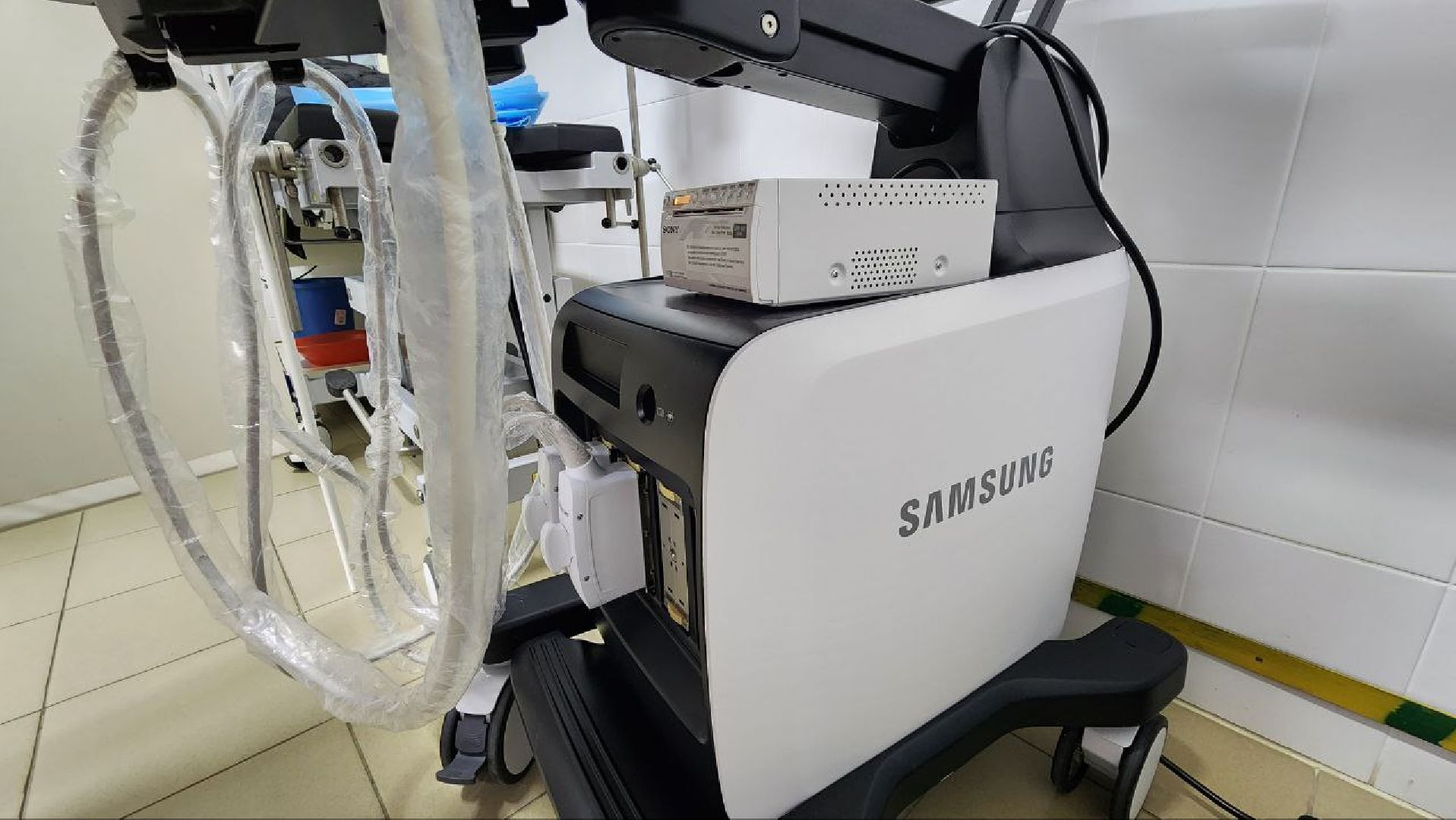 Дмитров, Дмитровская больница, УЗИ для урологии, Минздрав,