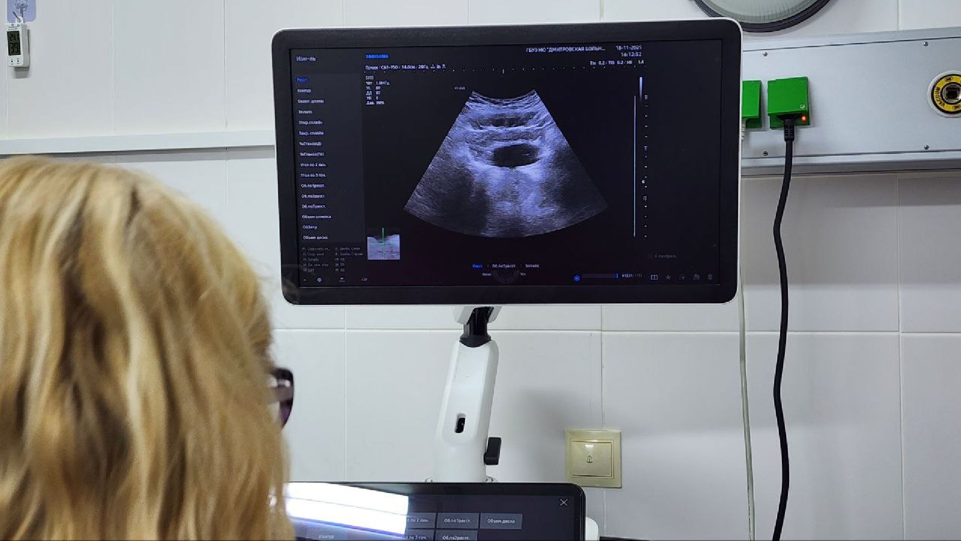 Дмитров, Дмитровская больница, УЗИ для урологии, Минздрав,