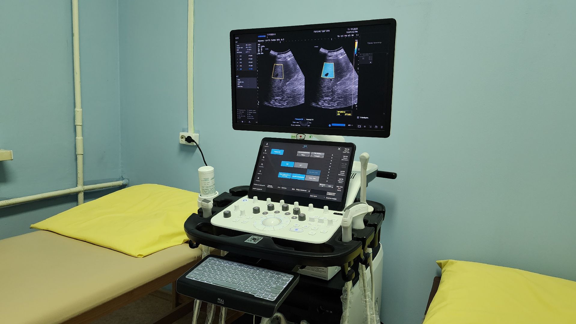 медицина, аппарат узи, медтехника, лосино-петровский,