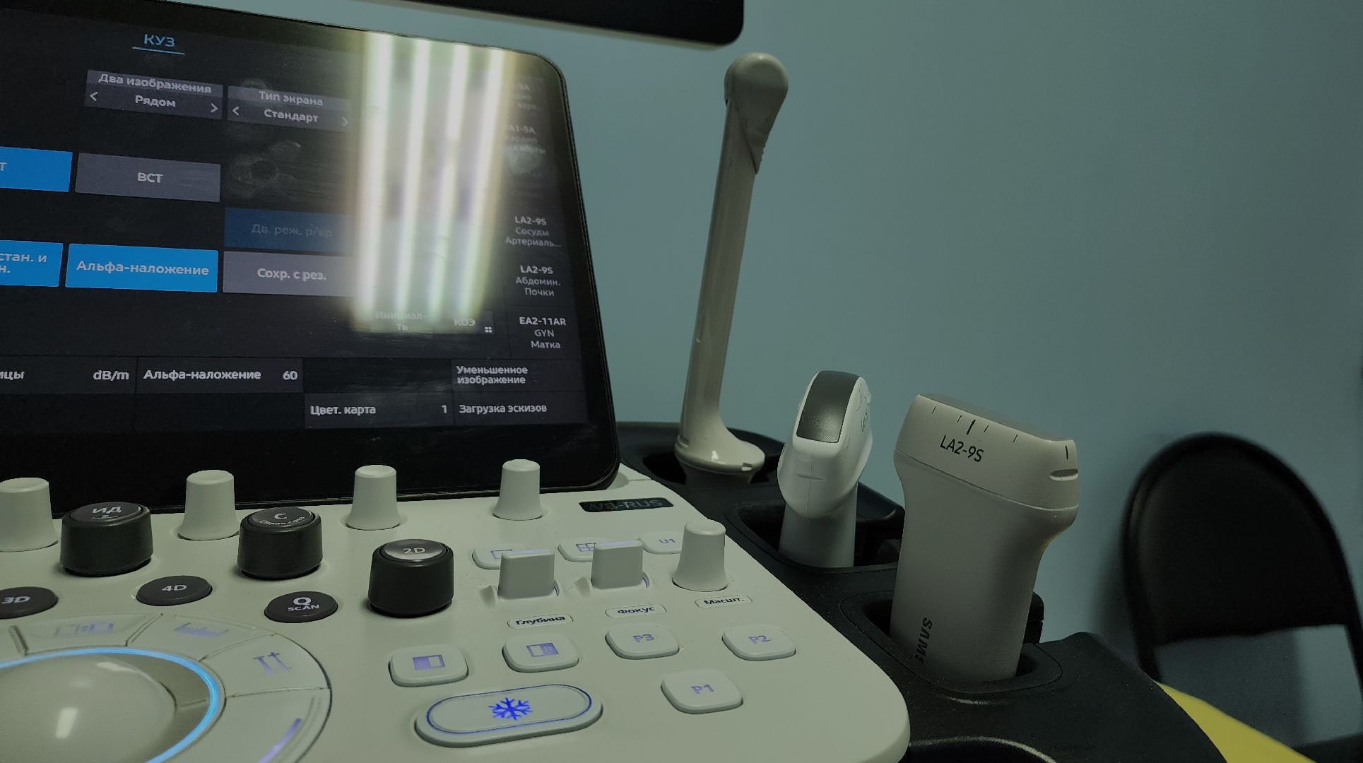 медицина, аппарат узи, медтехника, лосино-петровский,