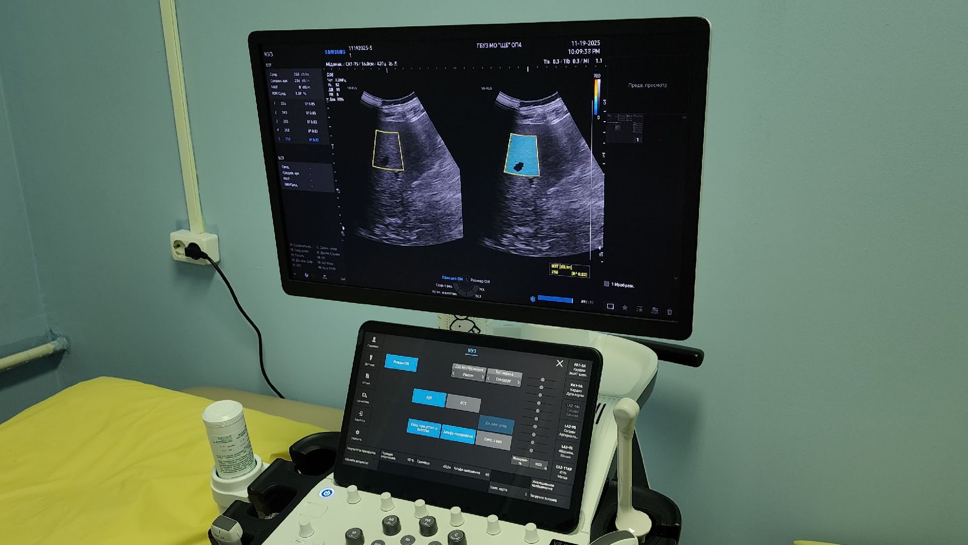 медицина, аппарат узи, медтехника, лосино-петровский,