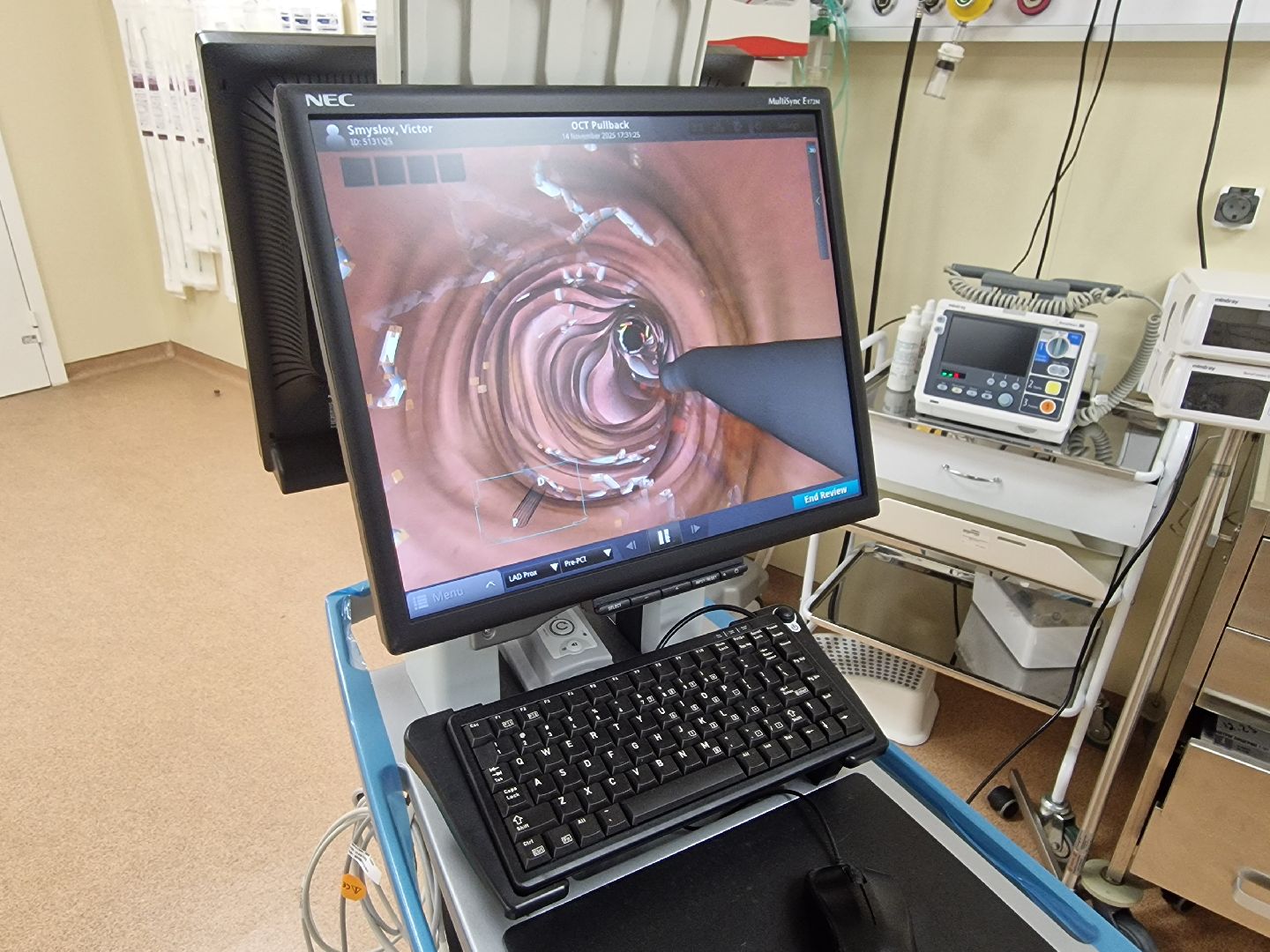 воскресенск, воскресенская больница, сосудистый центр,