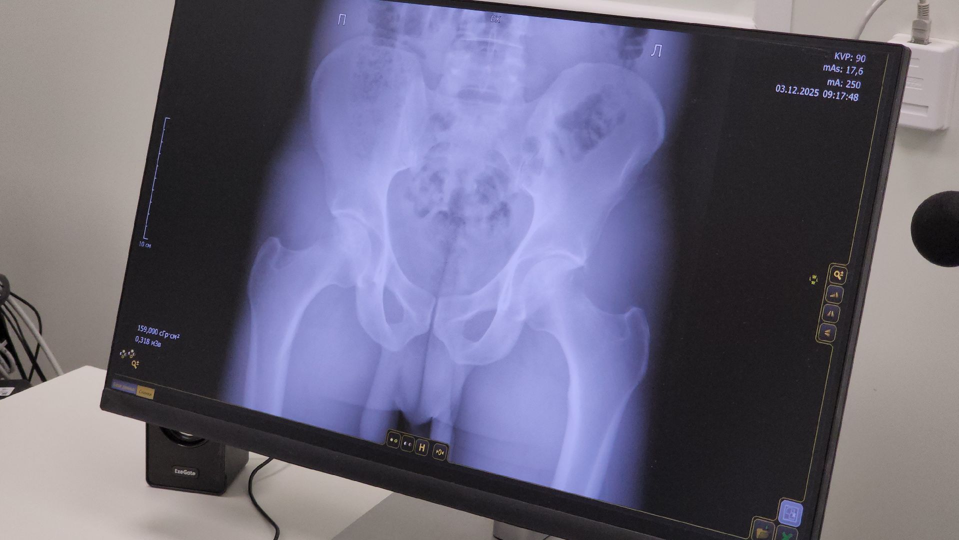 красногорск, медицина, рентген-аппарат, новое оборудование,