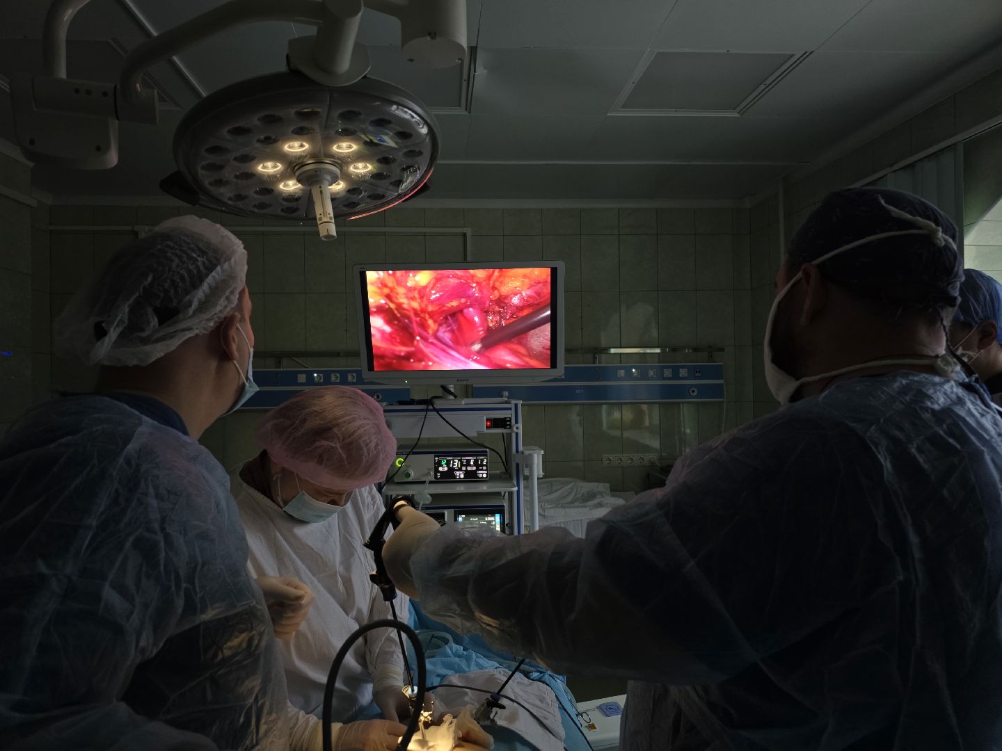 наро-фоминская больница, апрелевка, лапароскопическая методика лечения, хирургия,